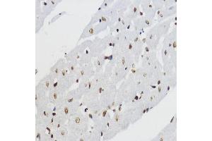 Immunohistochemistry of paraffin-embedded rat heart using Acetyl-Histone H3-K27 antibody (ABIN7267670) at dilution of 1:200 (40x lens). (Histone 3 antibody  (H3K27))