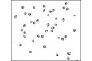 Immunocytochemistry of NOD2 in Jurkat cells with this product at 5 μg/ml. (NOD2 antibody  (N-Term))