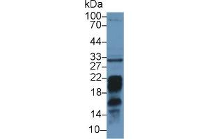 Detection of PDL2 in Mouse Liver lysate using Polyclonal Antibody to Programmed Cell Death Protein 1 Ligand 2 (PDL2) (PDCD1LG2 antibody  (AA 36-219))