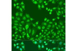 Immunofluorescence analysis of U2OS cells using CTCF Polyclonal Antibody at dilution of 1:100. (CTCF antibody)
