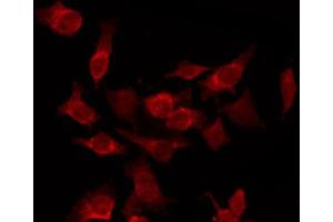 ABIN6266829 staining HepG2 by IF/ICC. (Cyclin-Dependent Kinase 15 (ALS2CR7) (Internal Region) antibody)