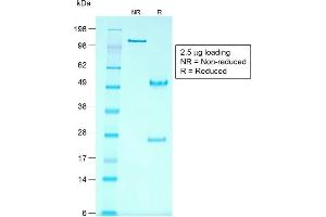 SDS-PAGE Analysis Purified Glypican-3 Mouse Recombinant Monoclonal Ab (rGPC3/863). (Recombinant Glypican 3 antibody)