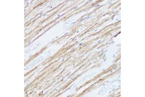Immunohistochemistry of paraffin-embedded mouse heart using MGLL Rabbit pAb (ABIN6128306, ABIN6143823, ABIN6143824 and ABIN6222352) at dilution of 1:50 (40x lens). (MGLL antibody  (AA 1-303))