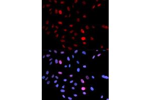 Immunofluorescence analysis of U2OS cells using Phospho-SMC1A-S957 antibody (ABIN5969934). (SMC1A antibody  (pSer957))