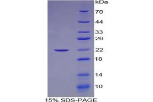SDS-PAGE analysis of Human Laminin gamma 2 Protein.