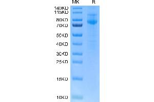 IL27 Receptor alpha Protein (AA 34-516) (His tag)