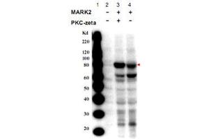 Western blot using MARK2 (phospho T595) polyclonal antibody  shows detection of a band at ~82 kDa corresponding to phosphorylated MARK2 (arrowhead).