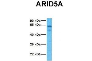Host:  Rabbit  Target Name:  ARID5A  Sample Tissue:  Human NCI-H226  Antibody Dilution:  1. (ARID5A antibody  (N-Term))