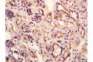 Formalin-fixed and paraffin embedded human kidney labeled with Anti-Megalin Polyclonal Antibody, Unconjugated (ABIN750988) at 1:200 followed by conjugation to the secondary antibody and DAB staining (LRP2 antibody  (AA 3401-3500))