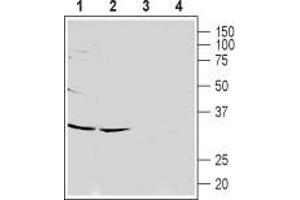 Western Blotting (WB) image for anti-Calcium Channel, Voltage-Dependent, gamma Subunit 7 (CACNG7) (AA 67-80), (Extracellular) antibody (ABIN7042995)
