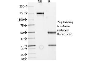 SDS-PAGE Analysis Purified IgA Secretory Component Mouse Monoclonal Antibody (ECM1/792). (Recombinant ECM1 antibody)