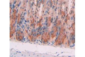 Used in DAB staining on fromalin fixed paraffin- embedded stomach tissue (MCCC1 antibody  (AA 484-717))