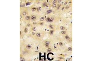 Immunohistochemistry (IHC) image for anti-Prospero Homeobox 1 (PROX1) antibody (ABIN3001422)