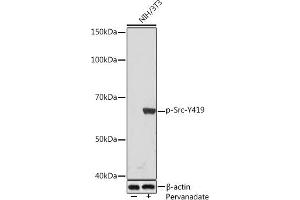 Western blot analysis of extracts of NIH/3T3 cells, using Phospho-Src-Y419 Rabbit mAb (ABIN7269728) at 1:1000 dilution. (Src antibody  (pTyr419))