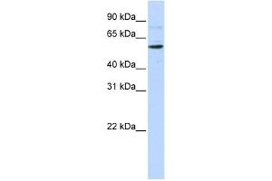 WB Suggested Anti-CDS1 Antibody Titration:  0. (CDS1 antibody  (Middle Region))