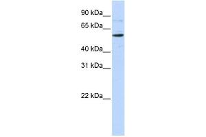 WB Suggested Anti-CDS1 Antibody Titration:  0.