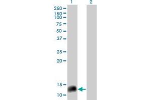 Western Blot analysis of NPY expression in transfected 293T cell line by NPY monoclonal antibody (M02), clone 2C10. (NPY antibody  (AA 29-97))