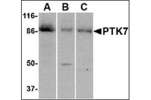 Western blot analysis of PTK7 in (A) human colon, (B) mouse kidney and (C) rat liver tissue lysate with this product at 1 μg/ml. (PTK7 antibody  (C-Term))