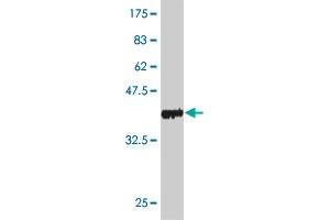 Western Blot detection against Immunogen (36. (PNPLA2 antibody  (AA 347-446))