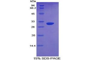 SDS-PAGE analysis of Mouse Cytochrome P450 1A1 Protein. (CYP1A1 Protein)