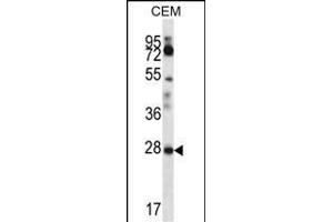 RARRES1 Antibody (C-term) (ABIN657062 and ABIN2846226) western blot analysis in CEM cell line lysates (35 μg/lane).