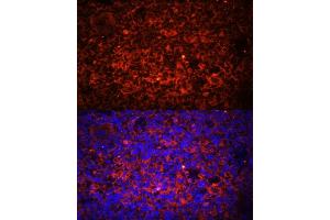 Immunofluorescence (IF) image for anti-Toll-Like Receptor 8 (TLR8) (AA 849-1041) antibody (ABIN3022015)