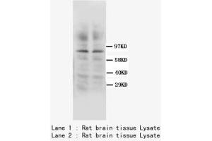 Image no. 1 for anti-Protein Kinase C, gamma (PRKCG) (C-Term) antibody (ABIN1493310) (PKC gamma antibody  (C-Term))