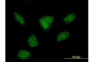 Immunofluorescence of purified MaxPab antibody to R3HDM2 on HeLa cell. (R3HDM2 antibody  (AA 1-637))