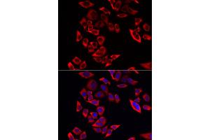 Immunofluorescence analysis of MCF-7 cells using RPL9 antibody (ABIN6291201).