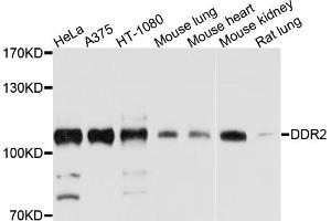 Western blot analysis of extracts of various cell lines, using DDR2 antibody (ABIN4903459) at 1:1000 dilution.