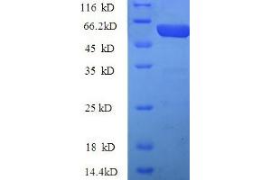SDS-PAGE (SDS) image for Pregnancy Zone Protein (PZP) (AA 472-821) protein (His tag) (ABIN5710197) (PZP Protein (AA 472-821) (His tag))