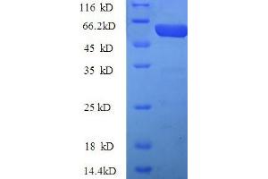 SDS-PAGE (SDS) image for Pregnancy Zone Protein (PZP) (AA 472-821) protein (His tag) (ABIN4979168)