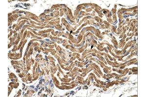 Immunohistochemistry (IHC) image for anti-ATP Synthase, H+ Transporting, Mitochondrial F1 Complex, beta Polypeptide (ATP5B) (N-Term) antibody (ABIN2783268) (ATP5B antibody  (N-Term))