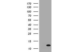 Image no. 1 for anti-S100 Calcium Binding Protein A6 (S100A6) antibody (ABIN1500784) (S100A6 antibody)