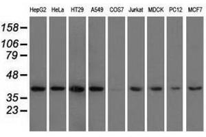 Image no. 2 for anti-3-hydroxyisobutyryl-CoA Hydrolase (HIBCH) antibody (ABIN1498653) (HIBCH antibody)
