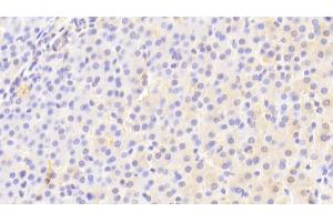 Detection of APOE in Human Liver Tissue using Polyclonal Antibody to Apolipoprotein E (APOE)