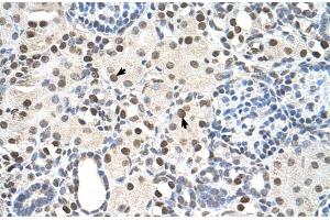 Rabbit Anti-PSME3 Antibody  Paraffin Embedded Tissue: Human Kidney Cellular Data: Epithelial cells of renal tubule Antibody Concentration: 4. (PSME3 antibody  (N-Term))