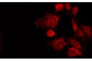 ABIN6275427 staining LOVO by IF/ICC. (PWWP2B antibody  (Internal Region))