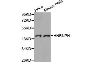 Western blot analysis of extracts of various cell lines, using HNRNPH1 antibody (ABIN5973515).