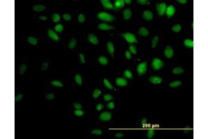 Image no. 5 for anti-Tripartite Motif Containing 33 (TRIM33) (AA 1006-1106) antibody (ABIN599250) (TRIM33 antibody  (AA 1006-1106))