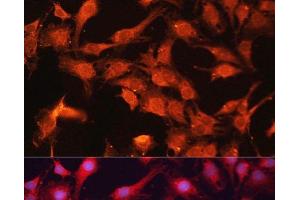 Immunofluorescence analysis of C6 cells using ABCB10 Polyclonal Antibody at dilution of 1:100. (ABCB10 antibody)