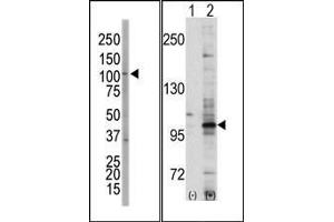 (LEFT)Western blot analysis of anti-EphA7 Pab in NCI-H460 cell lysate. (EPH Receptor A7 antibody  (C-Term))