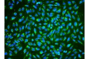 IF analysis of ALDH2 using anti-ALDH2 antibody (ABIN7603122).