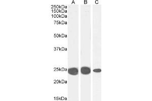 CBX5 anticorps  (Internal Region)