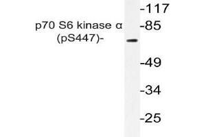 Western blot (WB) analyzes of p-p70 S6 kinase alpha antibody in extracts from A549 PMA cells. (RPS6KB1 antibody  (pSer447))