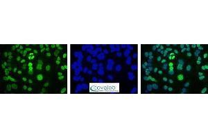 Image no. 5 for anti-DNA Repair Protein Apurinic Endonuclease antibody (ABIN5693483) (DNA Repair Protein Apurinic Endonuclease antibody)