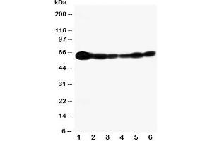 Western Blotting (WB) image for anti-SHC (Src Homology 2 Domain Containing) Transforming Protein 1 (SHC1) (C-Term) antibody (ABIN3032555)