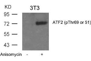 Western blot analysis of extracts from 3T3 cells untreated or treated with Anisomycin using ATF2(Phospho-Thr69 or 51) Antibody. (ATF2 antibody  (pThr69))