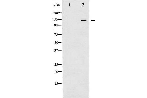 CASR antibody  (pThr888)