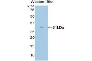 Western Blotting (WB) image for anti-Myosin IE (MYO1E) (AA 772-1033) antibody (ABIN1078394) (MYO1E antibody  (AA 772-1033))